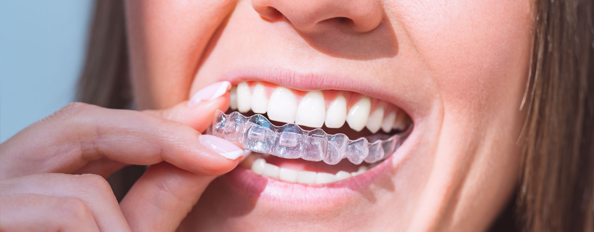 Woman wearing invisible dental aligners